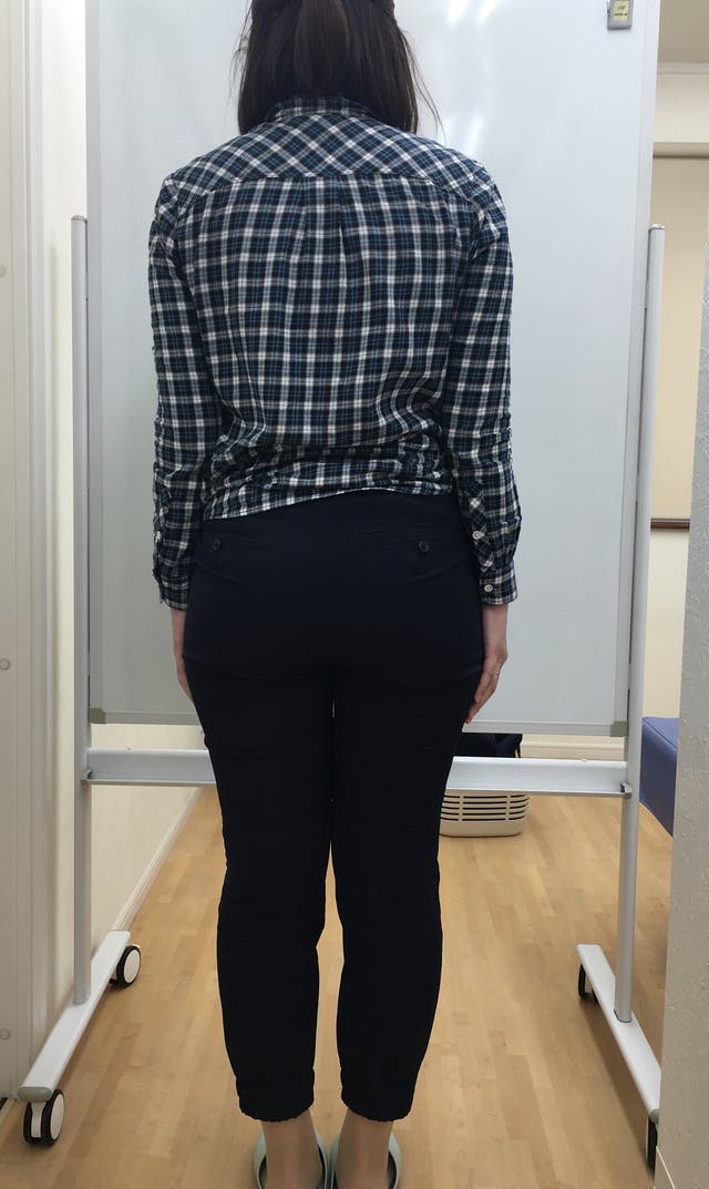 悩みだった下半身太りが解消できました(S様 30代 看護師)