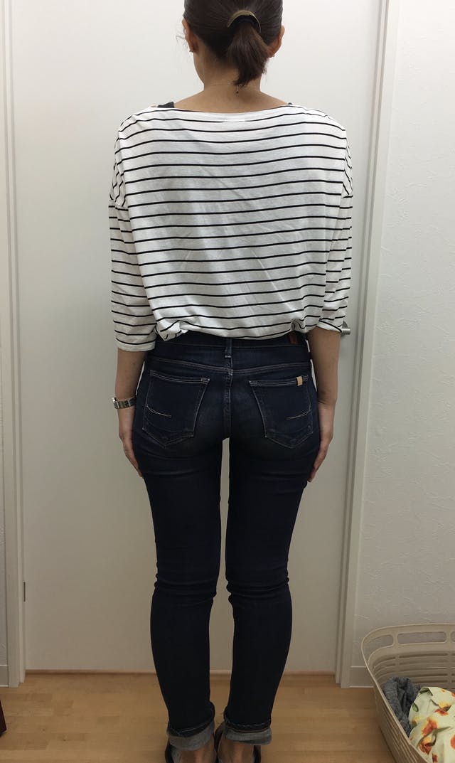 悩みだった下半身太りが解消できました(S様 30代 看護師)