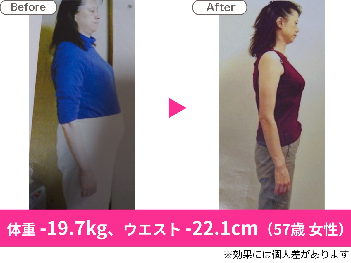 耳ツボダイエット 無料カウンセリング