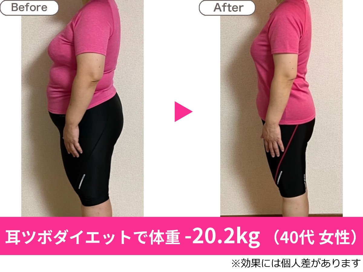 ダイエットカウンセリング+耳ツボダイエット 施術体験