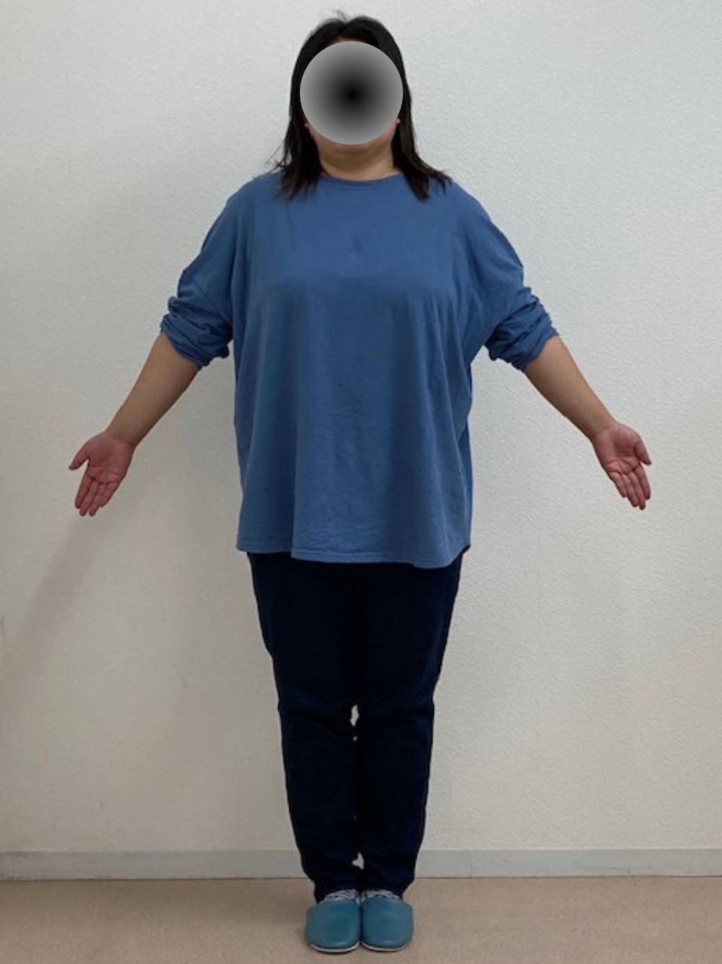 6ヶ月で-22kgを達成!(36歳)