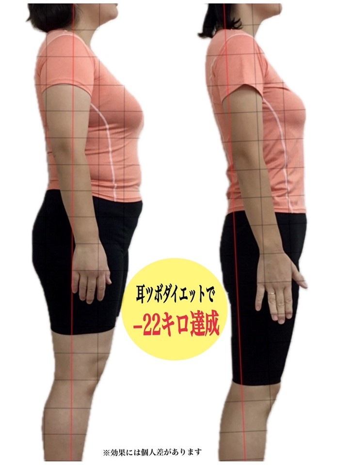 3ヶ月-10キロ目標 耳ツボ施術体験+カウンセリング受付中