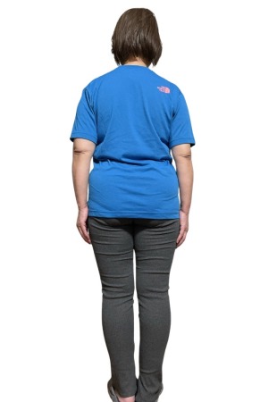 耳つぼダイエットで体重-10㎏達成(62歳 女性)