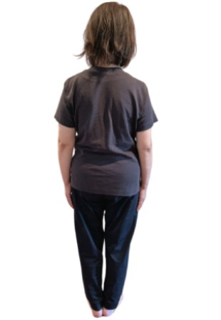 耳つぼダイエットで体重-10㎏達成(62歳 女性)