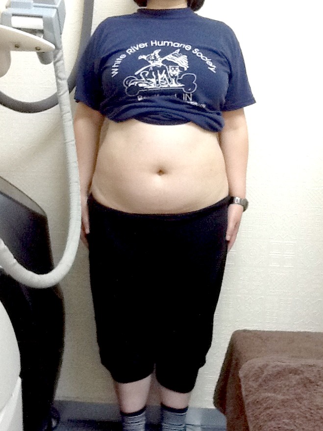 お腹から痩せた、3ヶ月で-12kgダイエット(女性 40歳)
