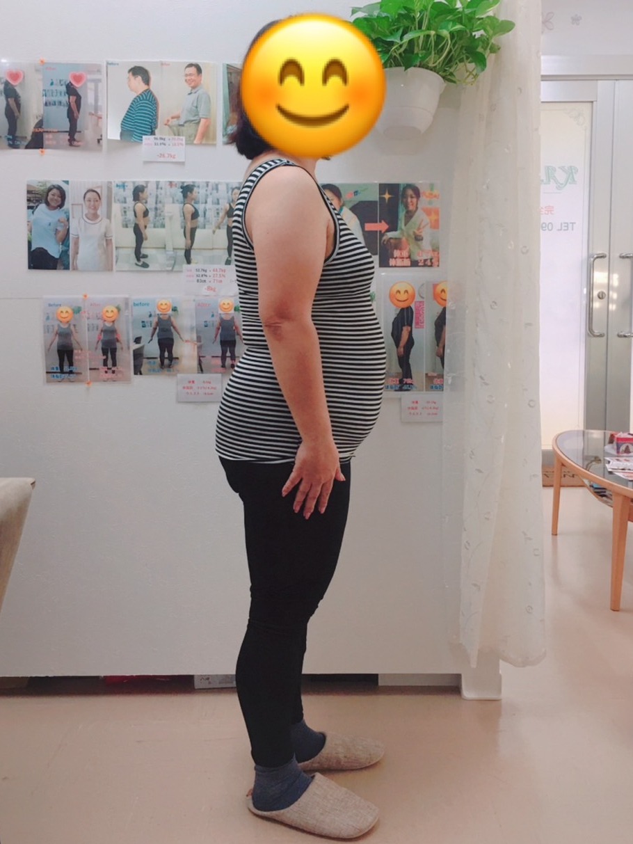 運動せずに-16kgのダイエット!(K様 49歳)