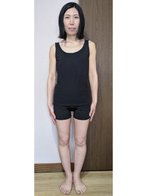 運動せずに-8.5kg減量！（30代 3ヶ月 代表 山田）