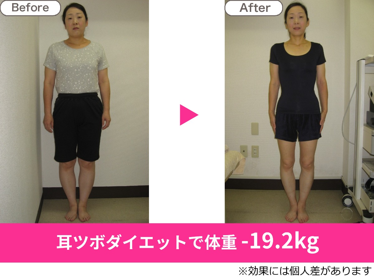 初回ダイエット カウンセリング+耳ツボ施術