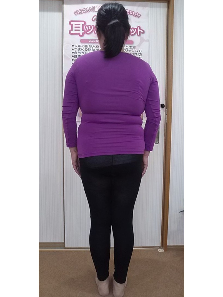 耳ツボダイエットで痩せました!(O様 50代 女性)