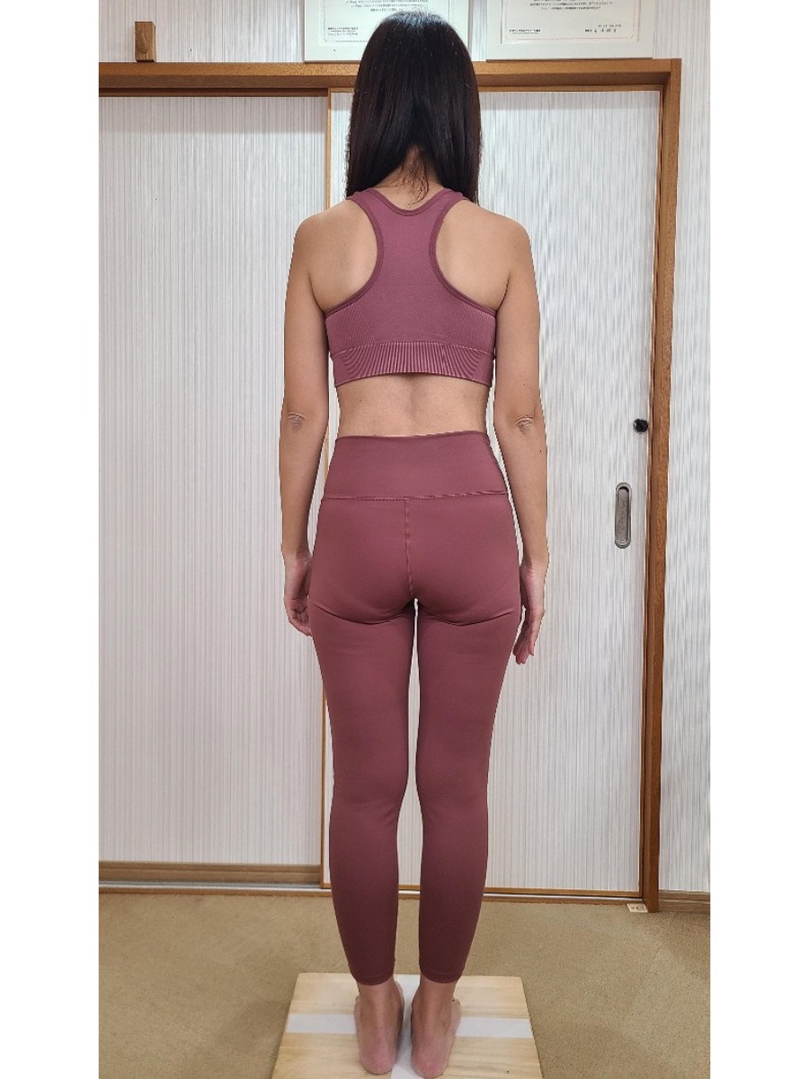 無理なく綺麗に痩せました!(M様 40代 女性)
