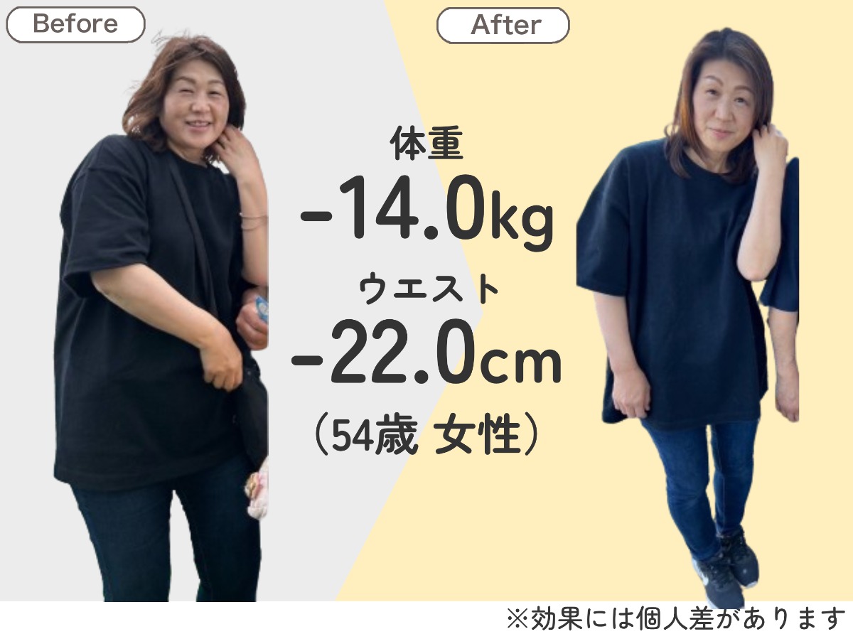 耳ツボダイエット施術1回体験+カウンセリング