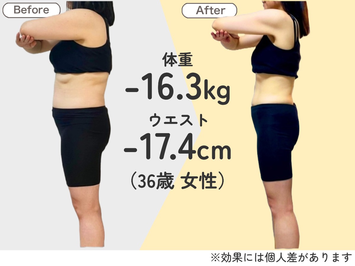 耳ツボダイエット 無料カウンセリング