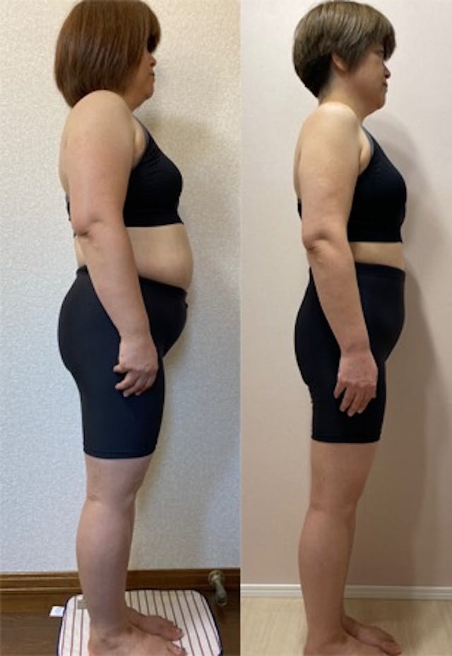 51歳/娘の成人式に痩せて写真を撮れました。