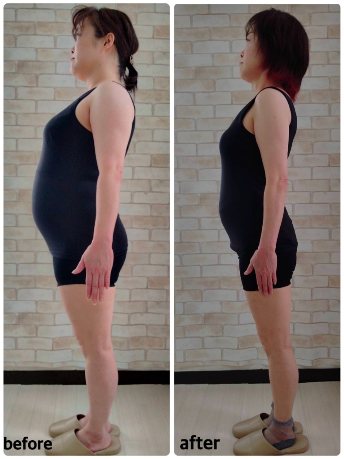 50代/5ヶ月 体重−20.2kg 体脂肪率−12.3%