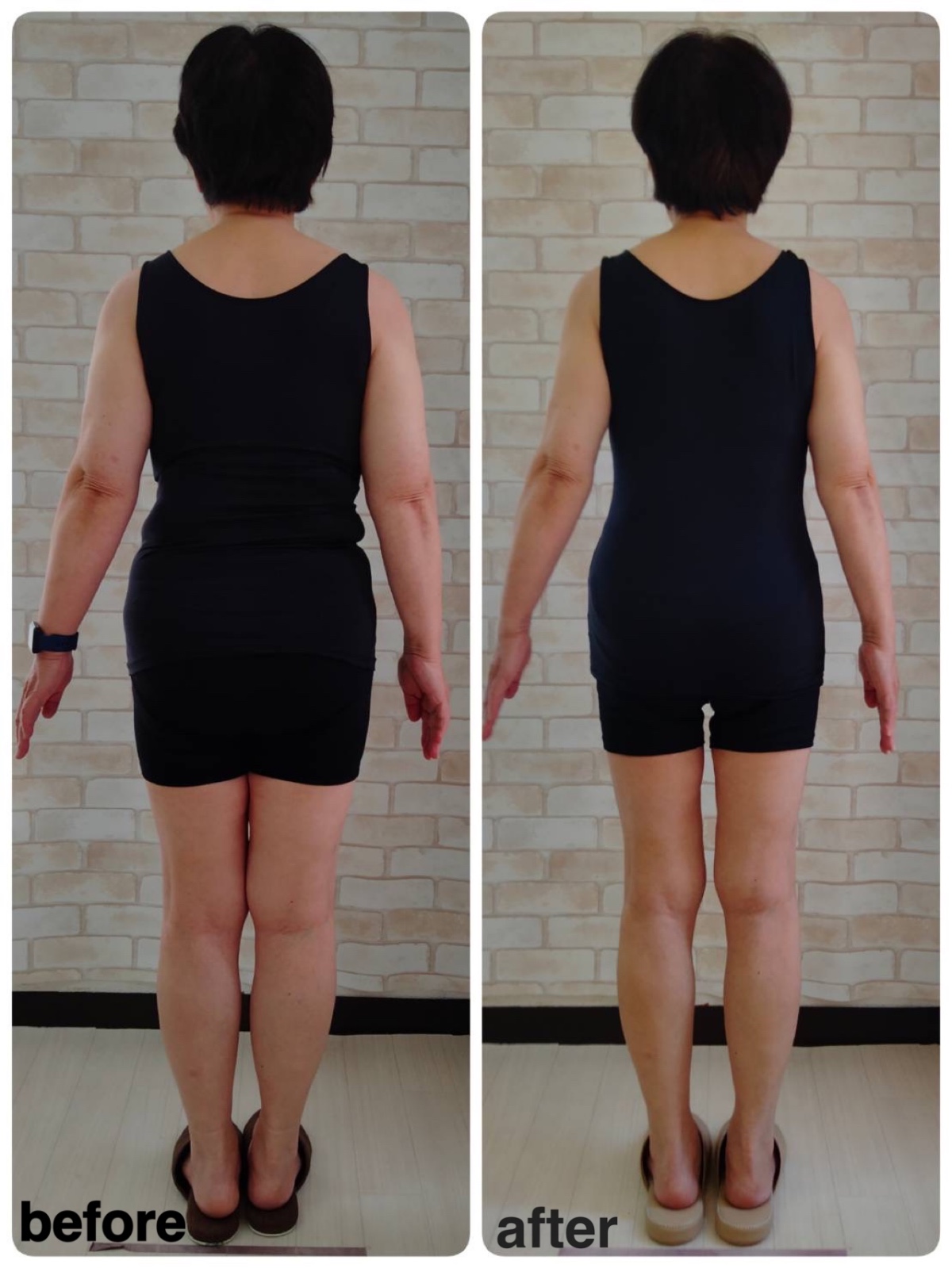 70代女性/3ヶ月 体重−10.3kg 体脂肪率−9%