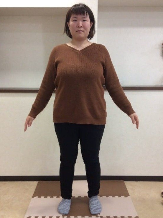 耳ツボダイエットで、-20.0kgの減量に成功!(30代)