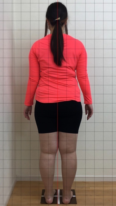 あきらめかけていましたが、やってよかった!(30代 会社員)