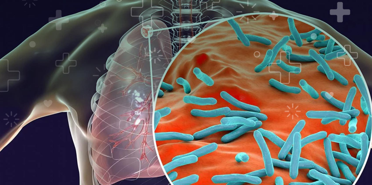Imagen de la nota 'Ciencia Nativa: Nueva herramienta contra la tuberculosis'