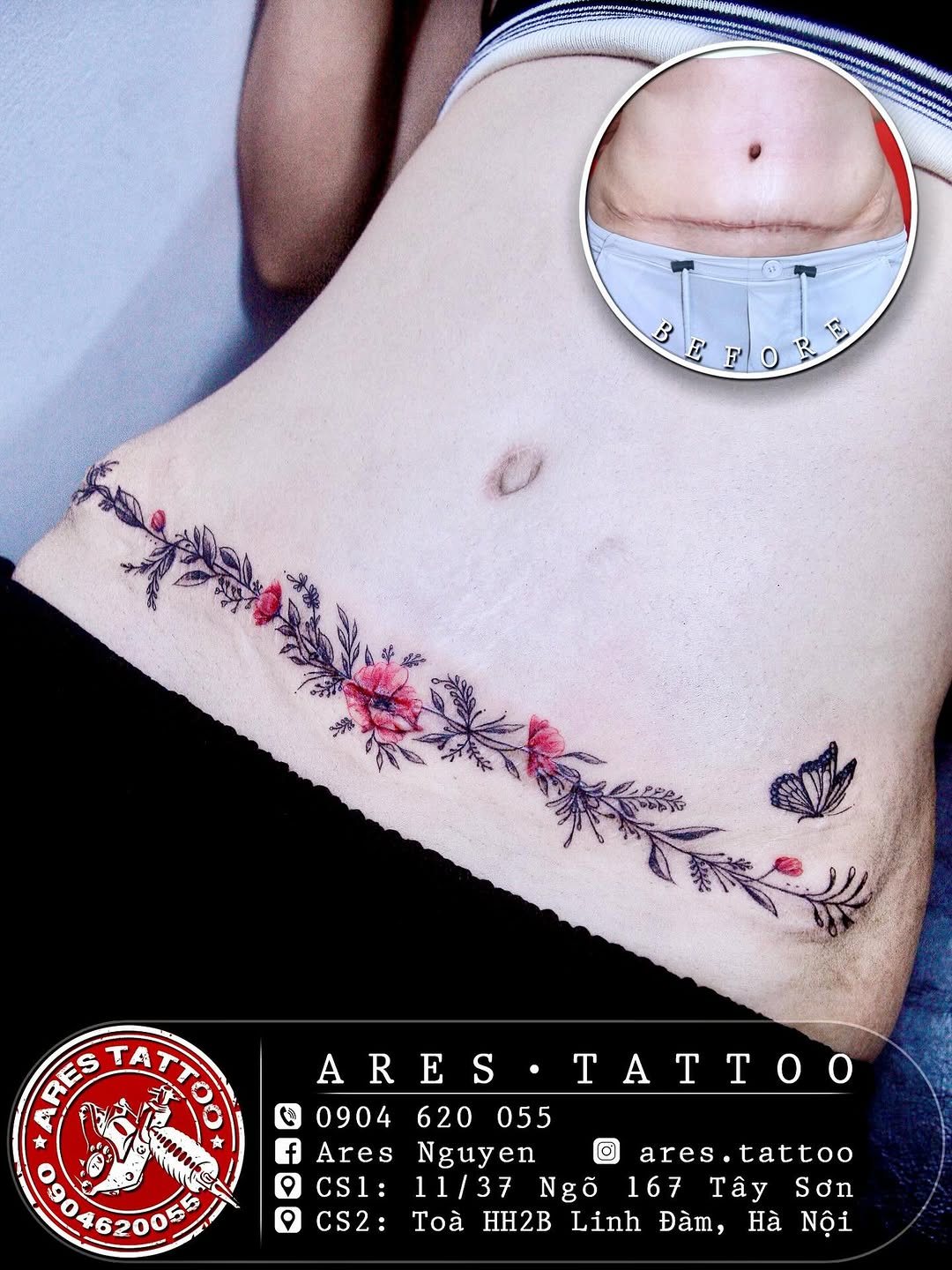 Hình xăm Cành Hoa Anh Túc Poppy (Che Sẹo) 
Biểu tượng của Morpheus, thần cai quản giấc mơ. Đại diện cho ảo mộng, ảo diệu, đẹp đẽ nhất
Mỗi màu hoa mang