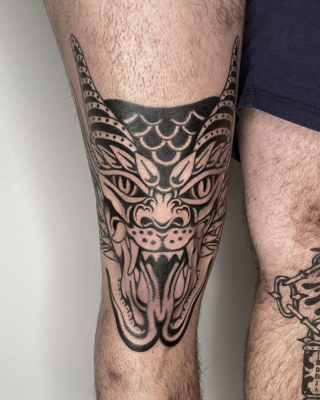 Swollen Knee for @yannickplfc 

––––––––––––––––––––––––––––

For more info or to book an appointment send an email, call or drop by

• Email: caspar@