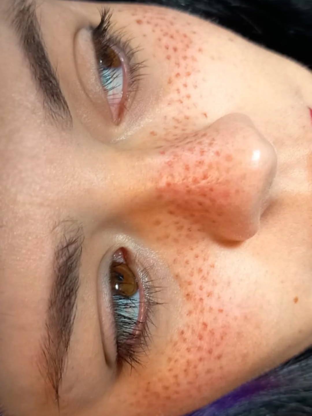 1° sesión de Micropigmentación de pequitas ✨
Luce un rostro juvenil con esta nueva tendencia☺️
 
Duración 1 a 3 años 
Procedimiento sin anestesia ❌
Co