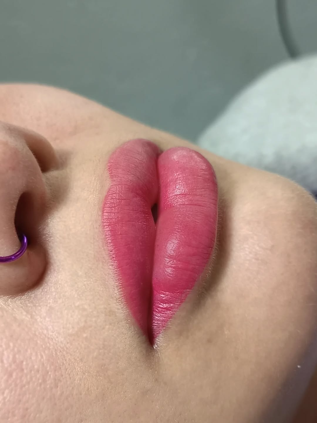 2° sesión de Full Lips para @fer_anfer20 

❌Procedimiento sin anestesia

Evaluación gratis✨