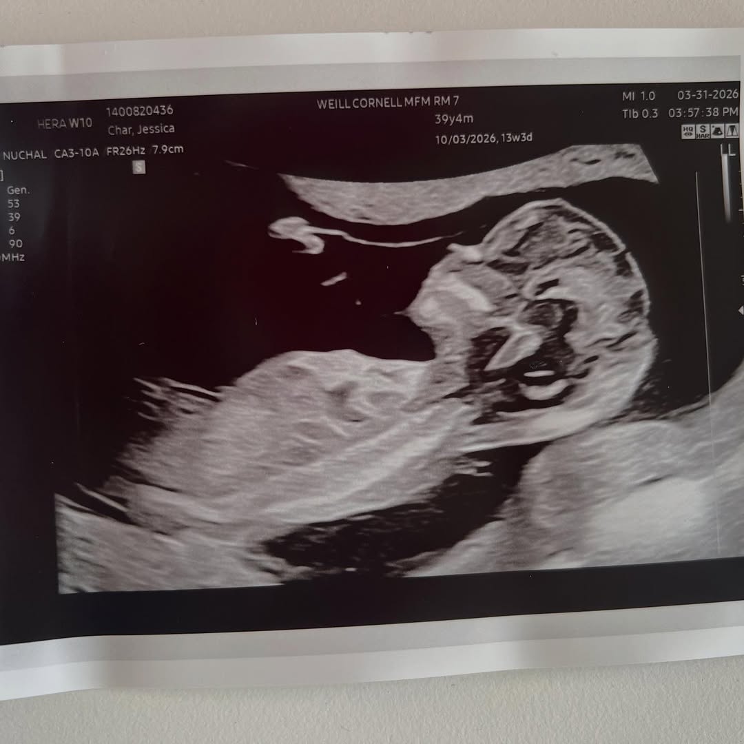 333 days ago, on May 2nd 2025, we went to City Hall and got married in the company of an artist, an actor, an it-girl, a dancer, and a skateboarder. 
