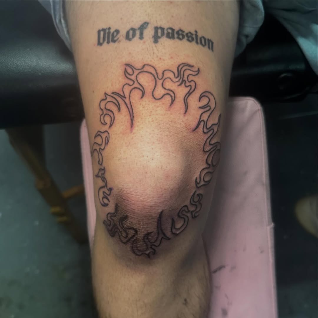 Paying It Forward: Knee Trauma