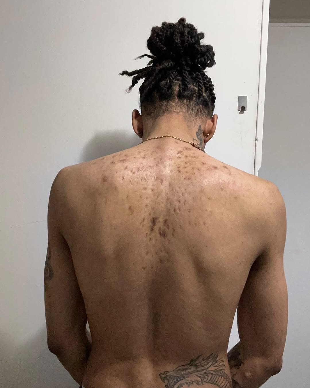 From scar to steel. A warrior’s past carved into armor…this back piece tells a story of pain, honor, and rebirth.

#SamuraiSpirit #CoverUpTattoo #Back