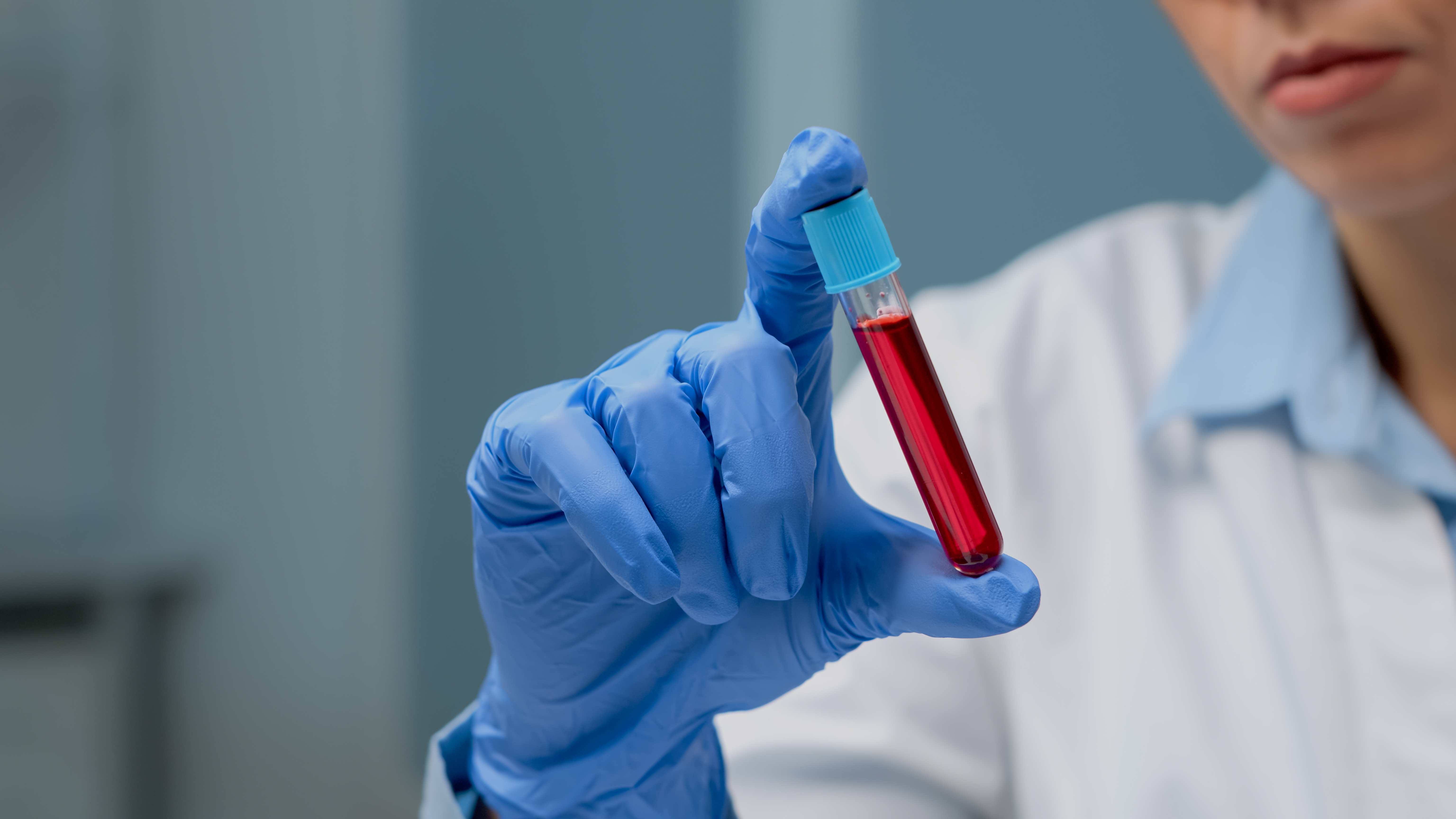 Exame de sangue que detecta Alzheimer chega ao Brasil