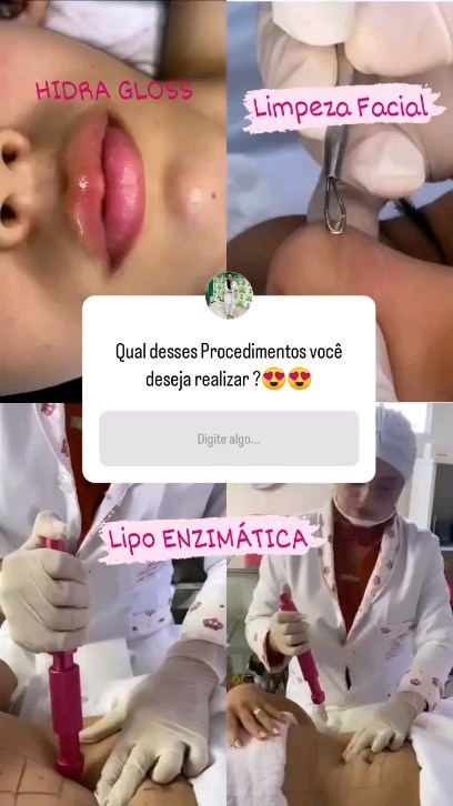 Instagram contest
