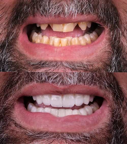 Rehabilitación oral
