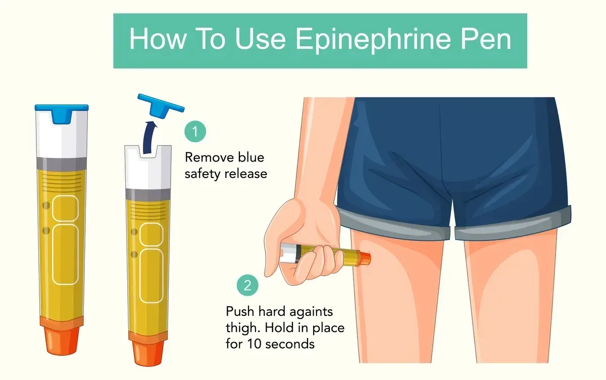 Illustration showing how to use an epinephrine pen by removing the blue safety release and pressing it firmly against the thigh for 10 seconds.