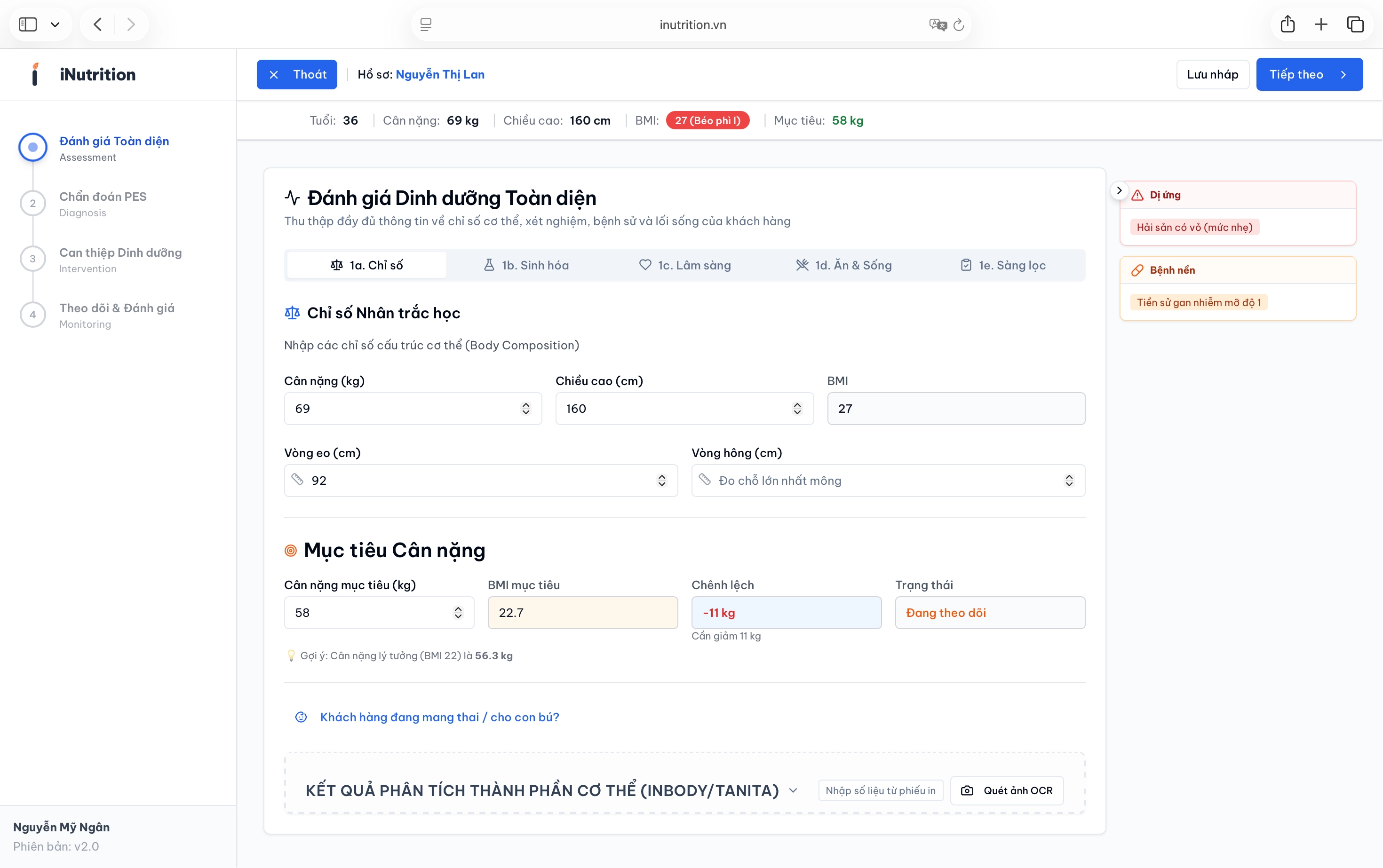 Quy trình Tư vấn - Bước 1