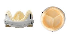 implant2.jpeg