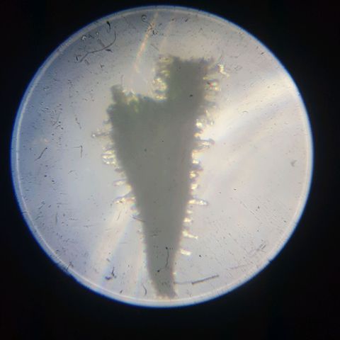 Florence Nightinggale growlog timeline photo