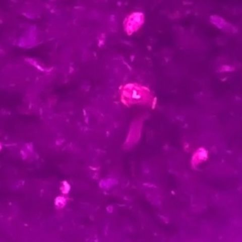 First Born growlog photo: SPROUTED