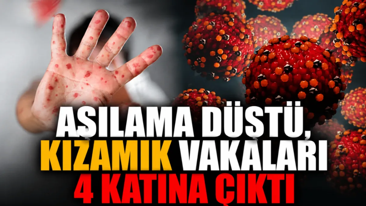 Aşılama düştü, kızamık vakaları 4 katına çıktı