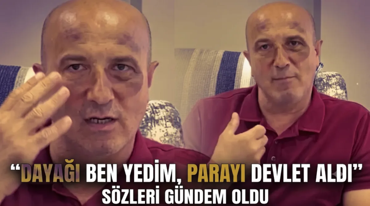 Dayağı Ben Yedim, Parayı Devlet Aldı" Sözleri Gündem Oldu