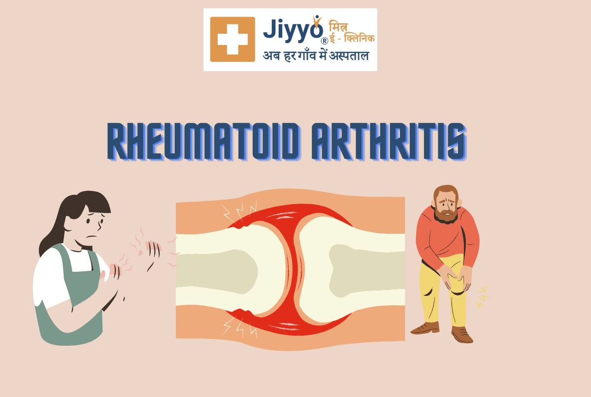 रूमेटाइड आर्थराइटिस के बारे में महत्वपूर्ण जानकारी 
