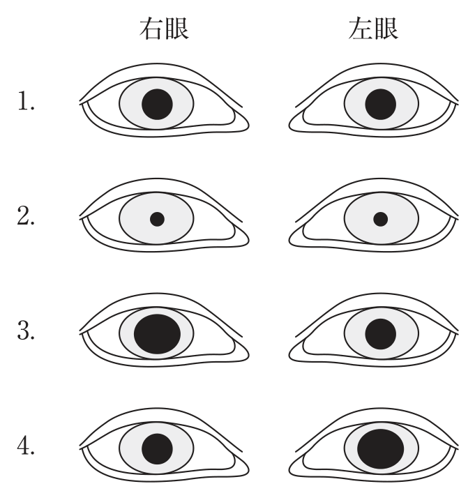 第112回 問215 の図 1