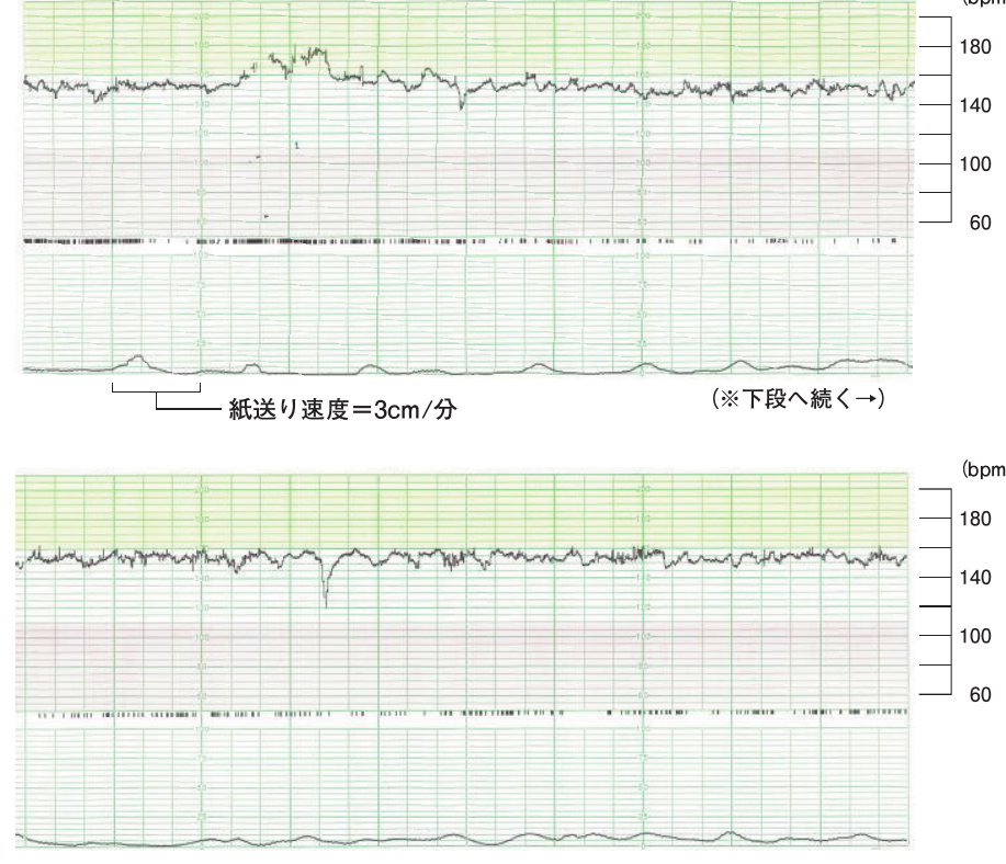 第100回 問51 の図 1