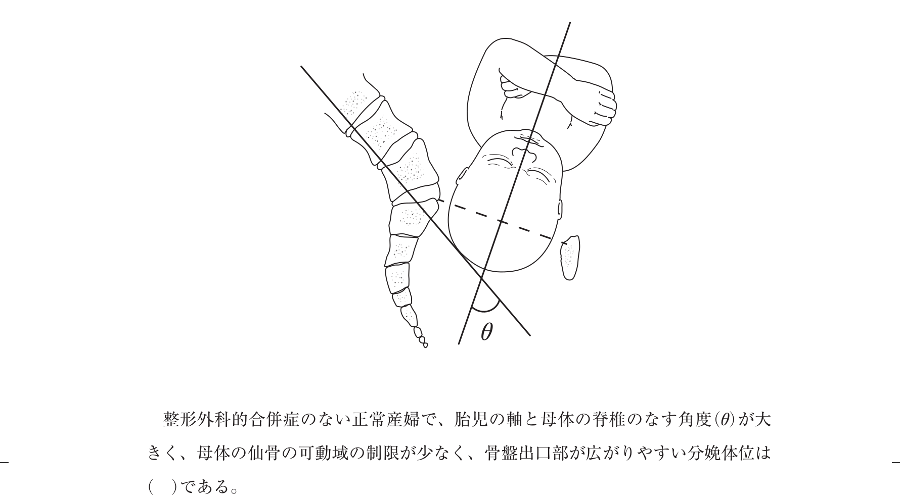 第102回 問77 の図 1