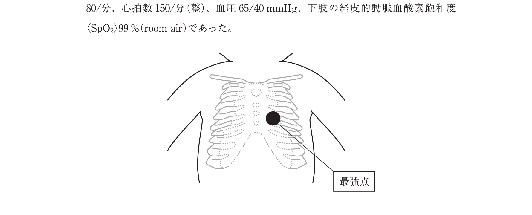 第104回 問84 の図 1
