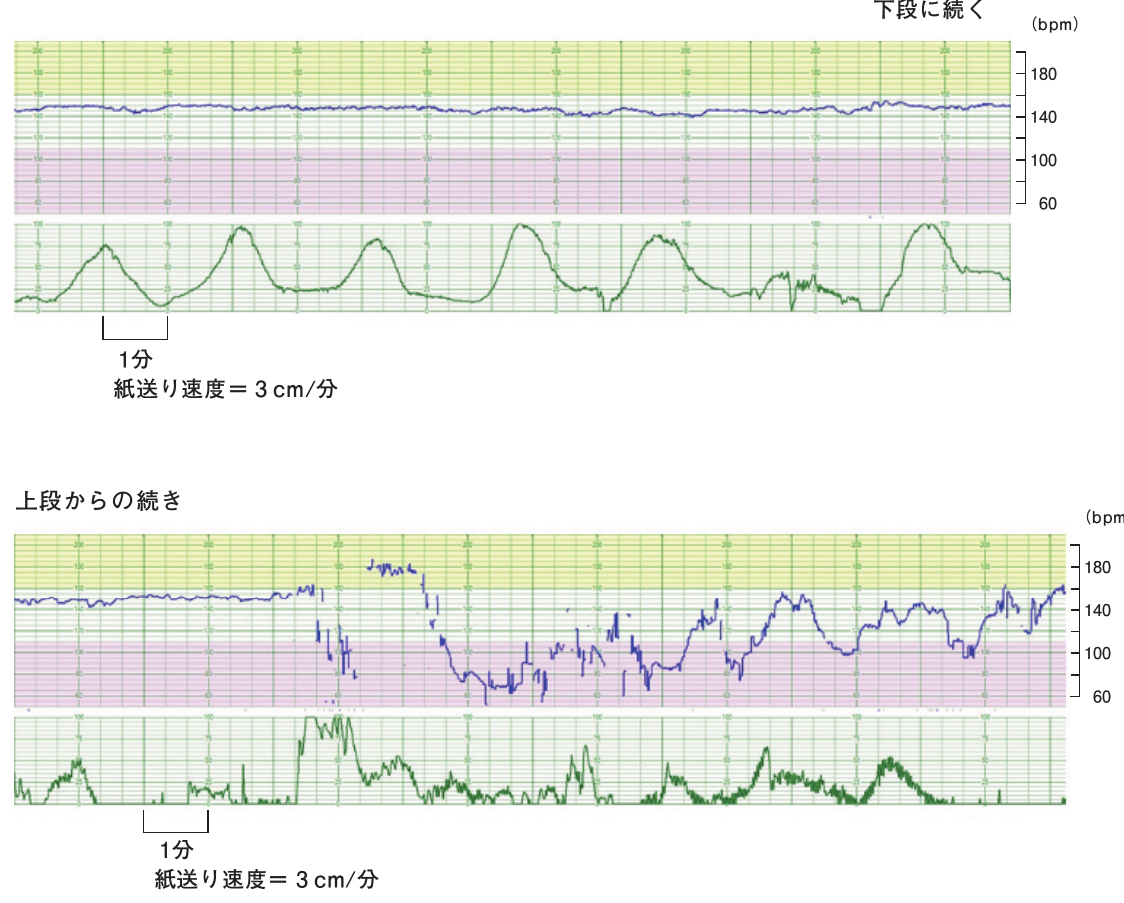 第105回 問48 の図 1