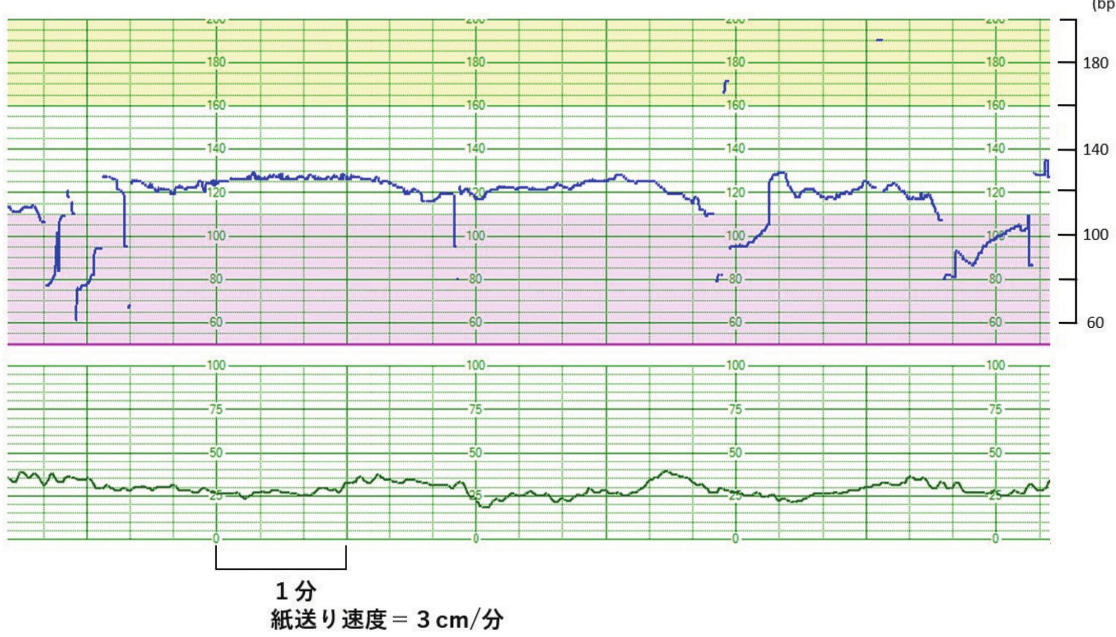 第107回 問53 の図 1