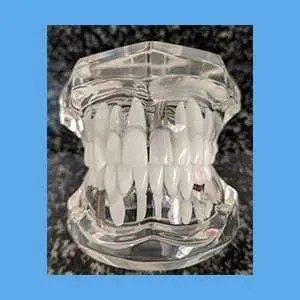 Dental Treatment Demonstration Model modelD1