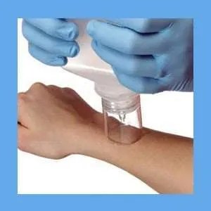 SPLASHCAP Wound Irrigation Shield