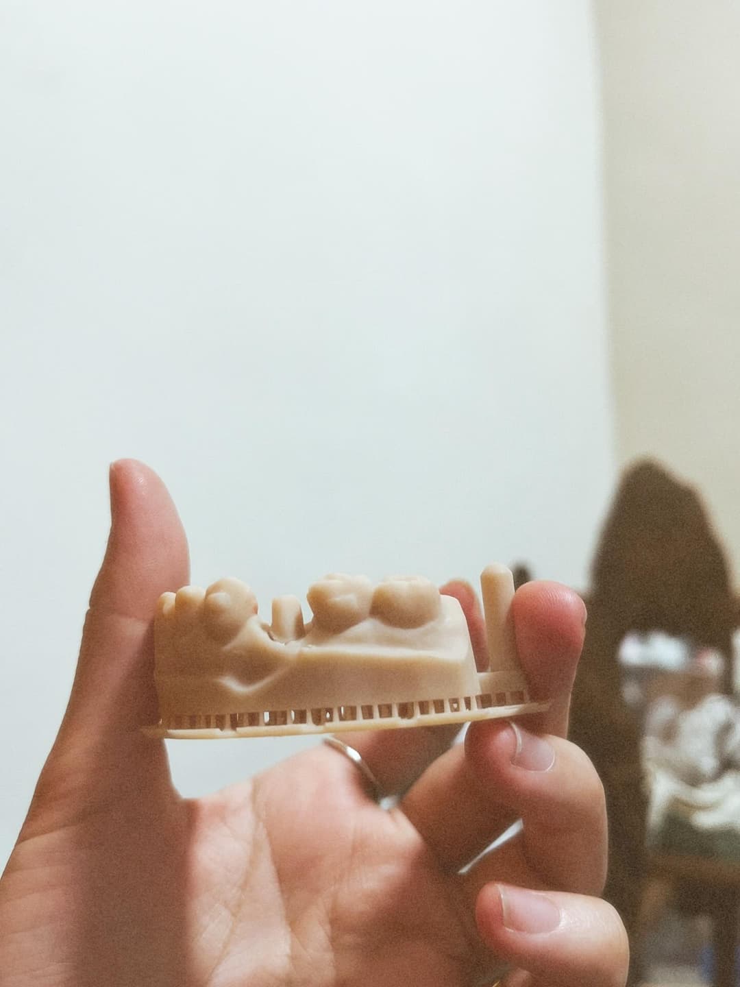 My Invisalign 6