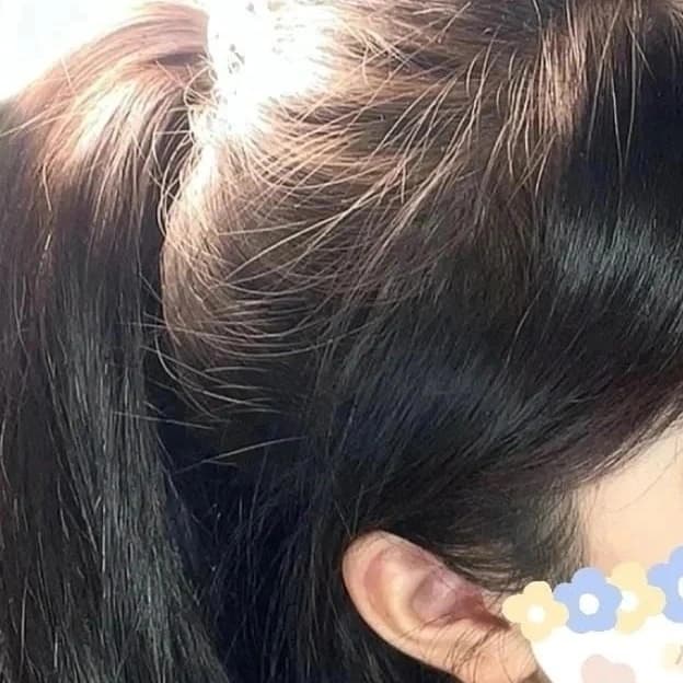 Hair growth tips to share